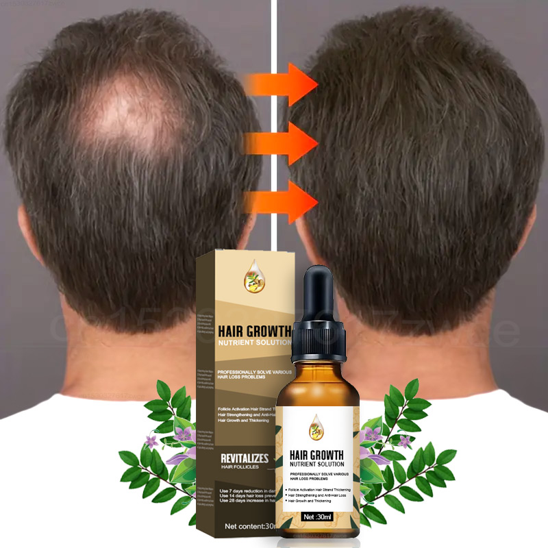 Health Wellness - Aceite de jengibre para el crecimiento